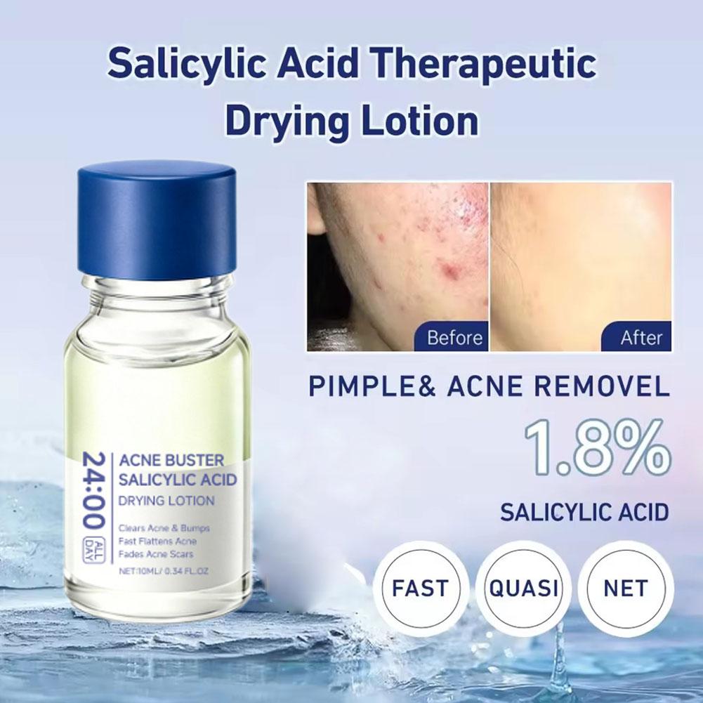 サリチル酸ニキビ除去剤、黒ずみオイルコントロール、毛穴を柔ら - Salicylic Acid Blackhead Remover のレビューと価格